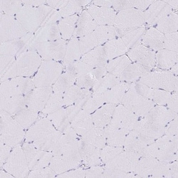 CXorf67 Antibody, Novus Biologicals 25 &mu;L | Buy Online | Novus Biologicals | Fisher Scientific